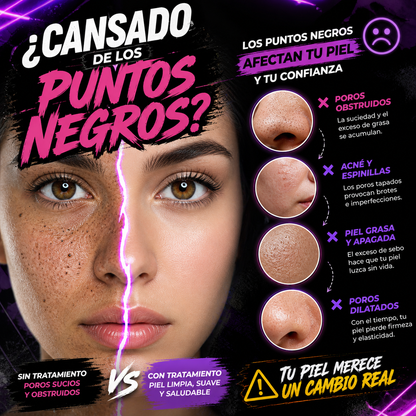 ¡ELIMINA LOS PUNTOS NEGROS EN MINUTOS!