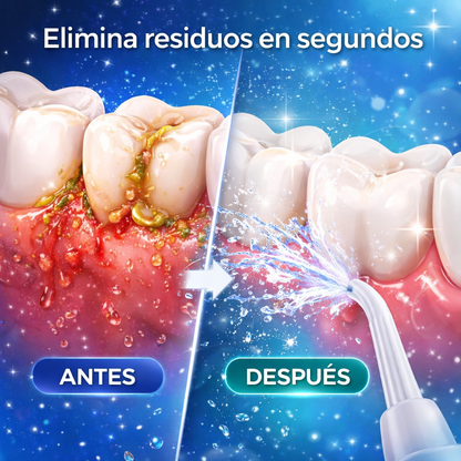 💦 ¡ADIÓS A LA SUCIEDAD ENTRE TUS DIENTES!
